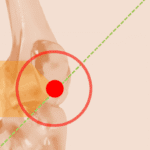 Imagen anatómica del codo humano con fondo beige, círculo rojo destacando la articulación y una línea diagonal verde que cruza la zona señalada.