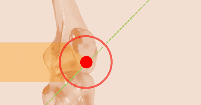 Imagen anatómica del codo humano con fondo beige, círculo rojo destacando la articulación y una línea diagonal verde que cruza la zona señalada.