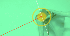 Imagen anatómica de un hombro humano con fondo verde, flecha roja apuntando a la articulación glenohumeral y líneas de referencia en blanco y amarillo.
