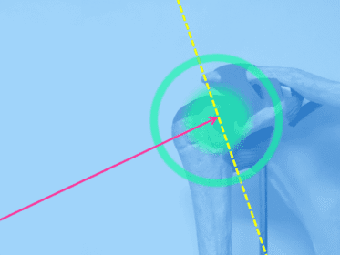 Imagen anatómica de una escápula y húmero con enfoque visual en la articulación del hombro, destacada por círculos verdes y líneas direccionales.