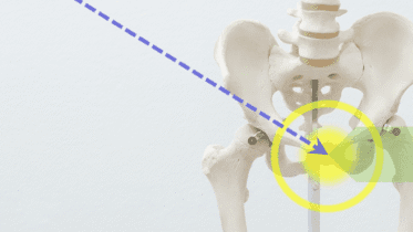 Modelo anatómico de pelvis con columna lumbar, mostrando una línea diagonal punteada hacia la articulación sacroilíaca derecha, destacada por un círculo amarillo y un foco luminoso, para explicar causas de dolor en la ingle mujer al caminar.