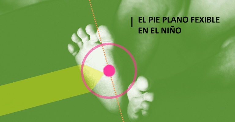 Portada del artículo “El pie plano flexible en el niño”, con imagen de pies infantiles sobre fondo verde y elementos gráficos que indican análisis médico del arco plantar, relacionada con el pie plano en niños de 1 a 2 años y hasta qué edad se puede corregir.