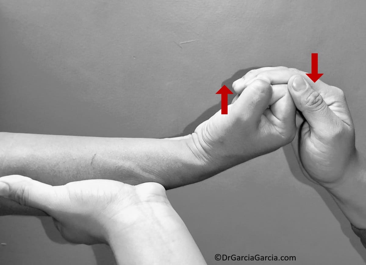 Figura 12. Prueba de Cozen invertida.