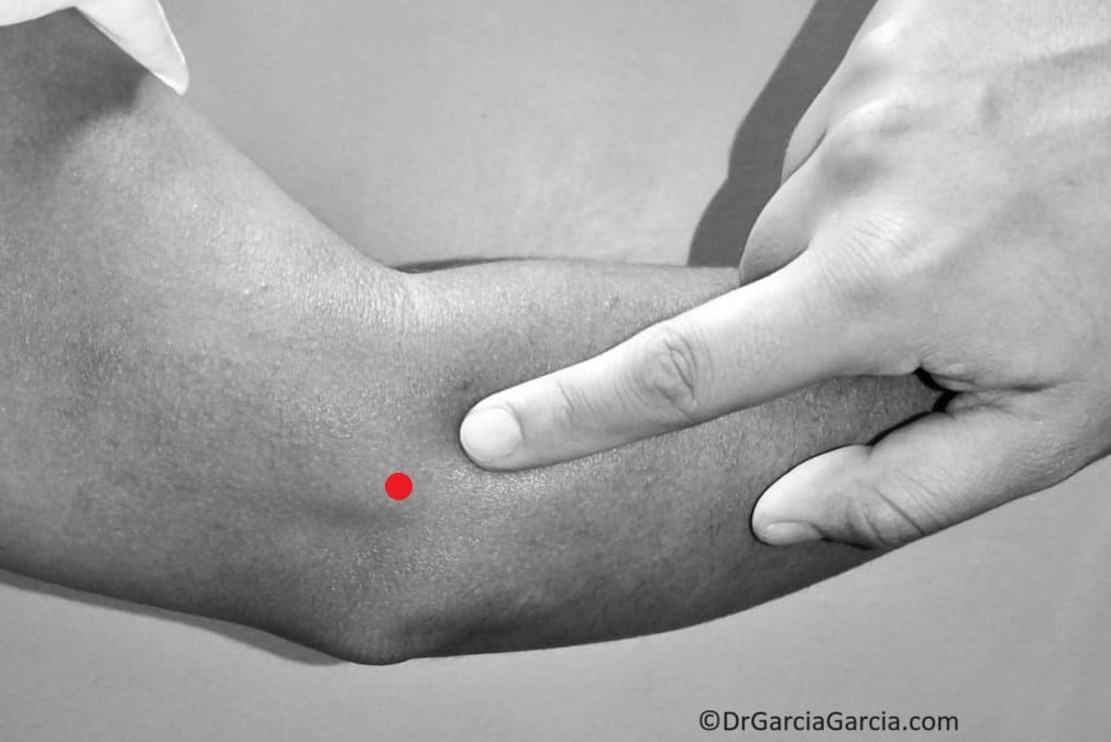 Figura 4. Dolor en 'punta de dedo'