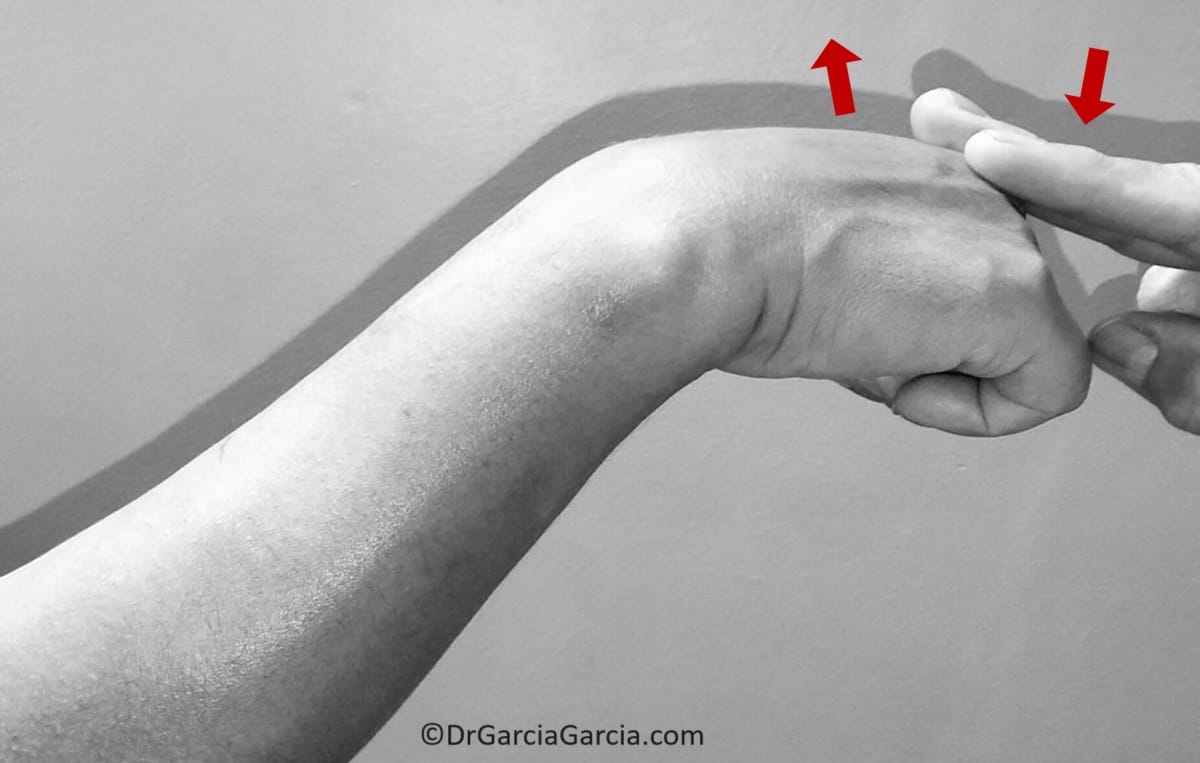 Figura 5. Prueba de Cozen