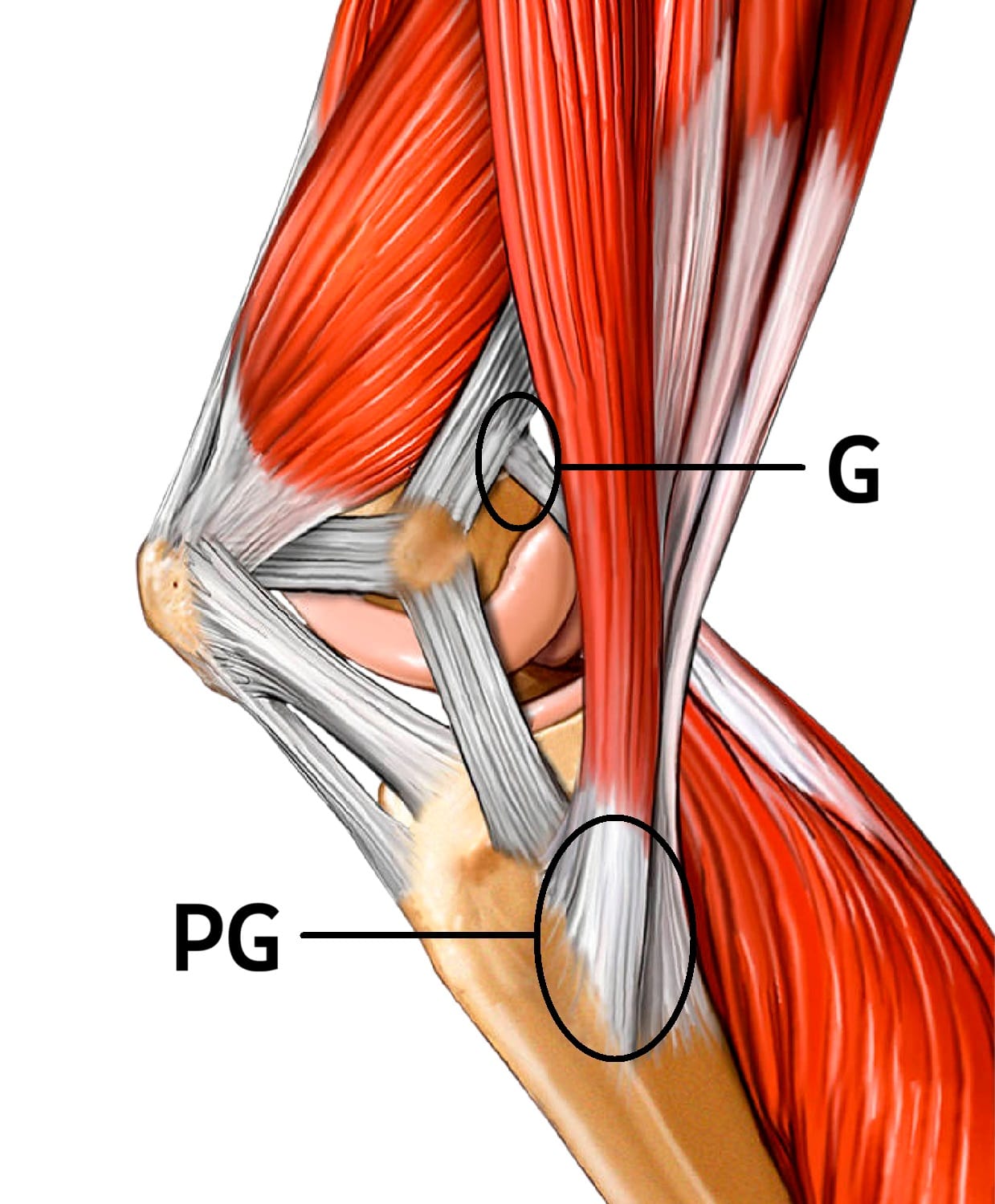 Rodilla derecha vista medial; inserciones de pata de ganso y gastrocnemio