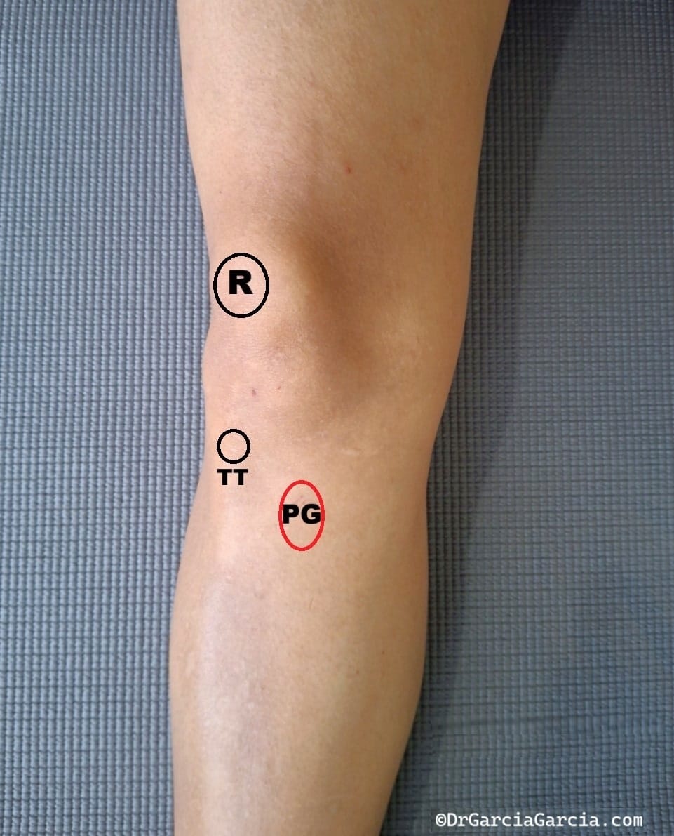 Rodilla derecha vista antero-medial; tuberosidad tibial