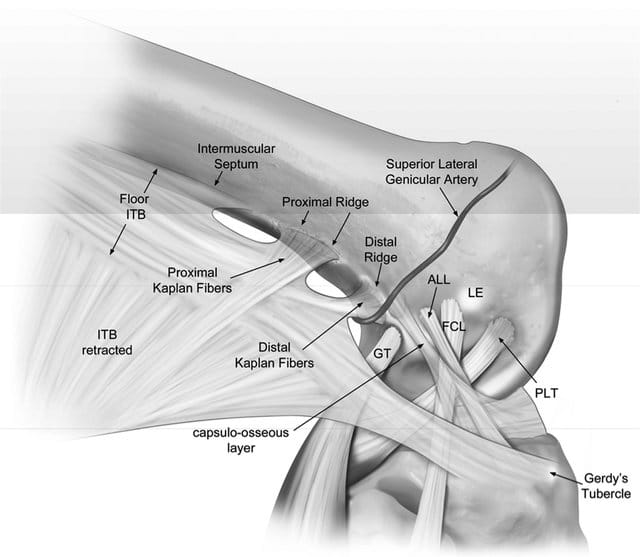 Ilustración anatómica de la cintilla iliotibial y sus inserciones distales y fibras de Kaplan