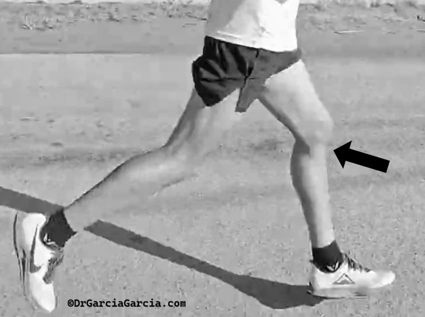 Momento de máxima fricción de la cintilla iliotibial sobre el epicóndilo femoral lateral durante la carrera