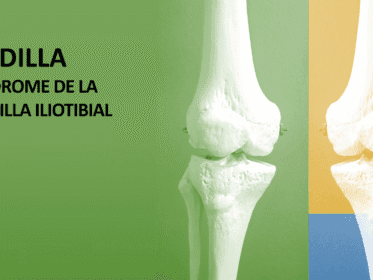 Banner sobre síndrome de la cintilla iliotibial con modelos óseos de rodilla.