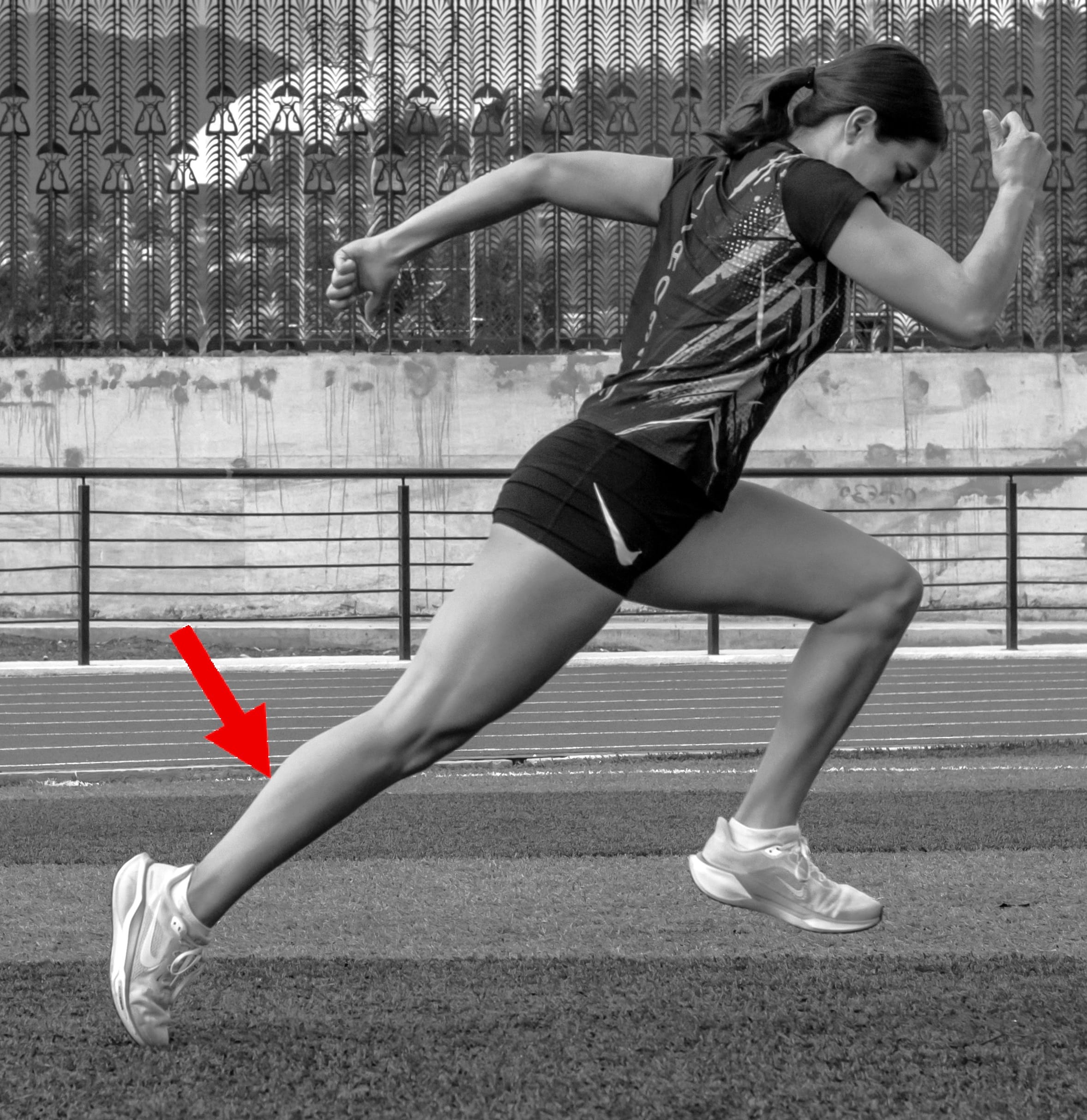 Figura 1a. Lesión muscular en gemelos