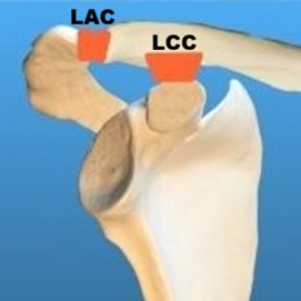Articulación acromioclavicular con ligamentos acromioclaviculares y coracoclaviculares intactos.